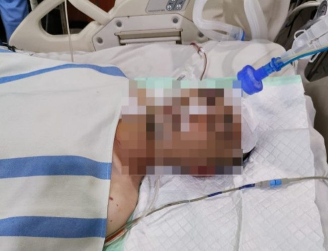 Kondisi Korban Pengeroyokan Oleh Geng Motor Masih Dirawat RSUD Abdul Wahab Syahrani